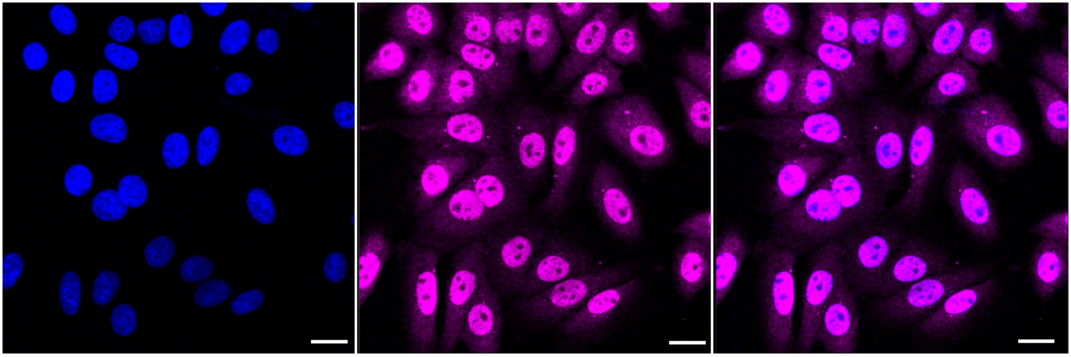 [KD Validated] Anti-ELAVL1 Rabbit mAb [69N77S12]