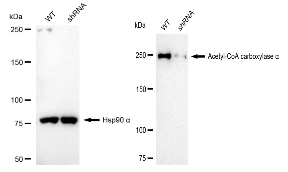 [KD Validated] Anti-ACACA Rabbit mAb [89R60N19]