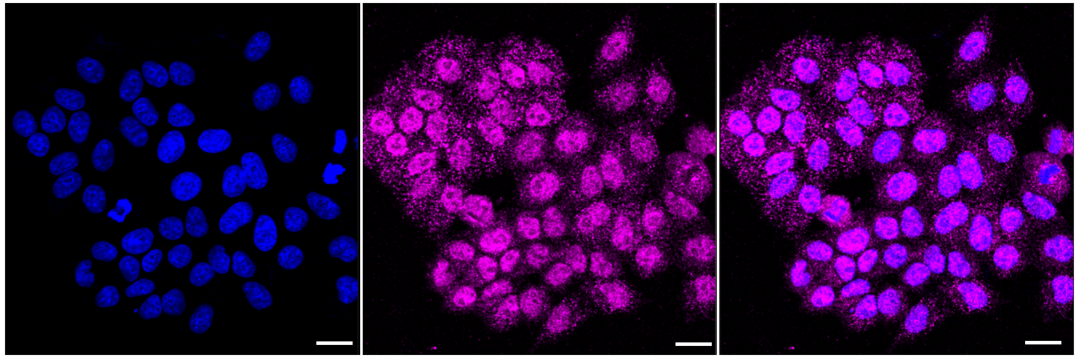 [KD Validated] Anti-CNTNAP1 Rabbit mAb [31S33A53]