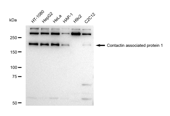 [KD Validated] Anti-CNTNAP1 Rabbit mAb [31S33A53]