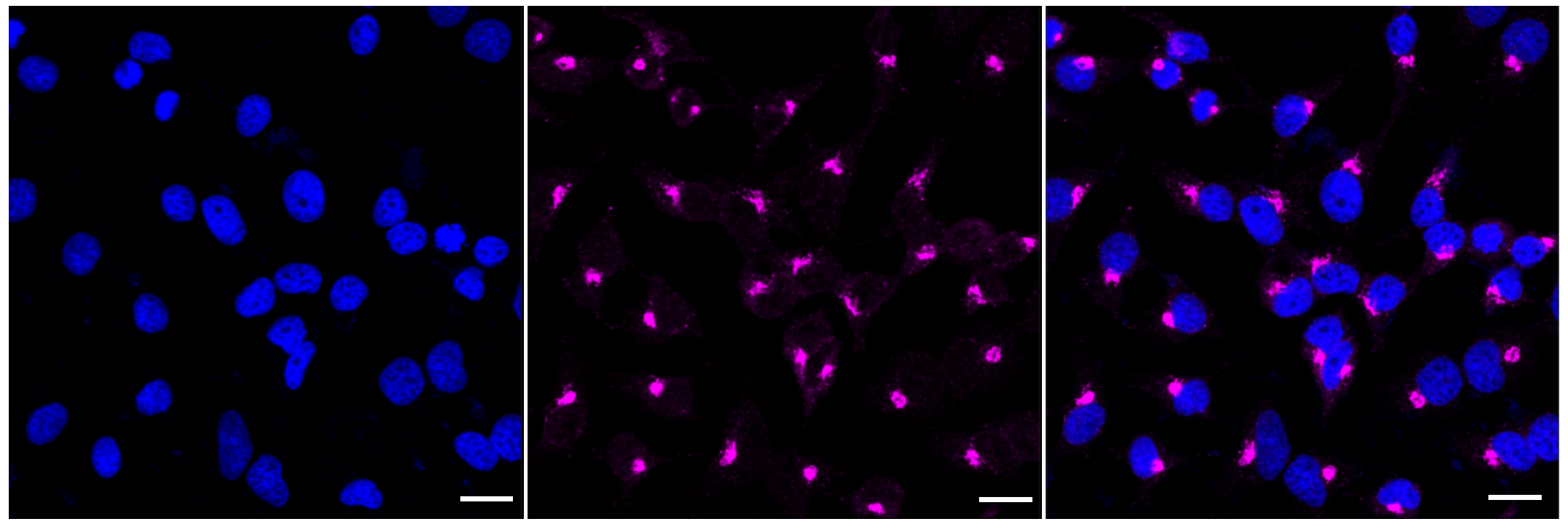 [KD Validated] Anti-GPI Rabbit mAb [53A92F42]