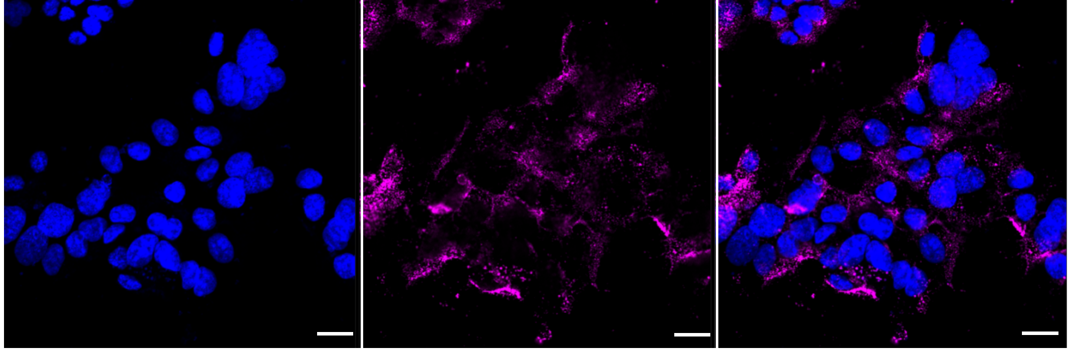 [KD Validated] Anti-GOLIM4 Rabbit mAb [54H01S22]
