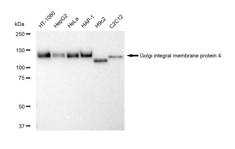 [KD Validated] Anti-GOLIM4 Rabbit mAb [54H01S22]