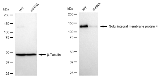 [KD Validated] Anti-GOLIM4 Rabbit mAb [54H01S22]