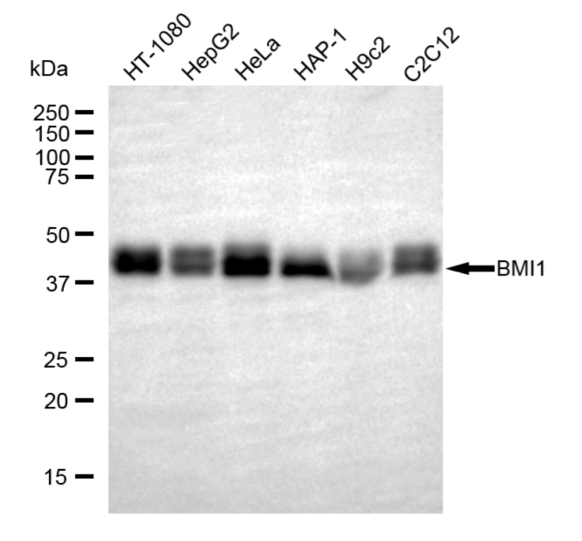 [KD Validated] Anti-BMI1 Rabbit mAb [86M84S90]