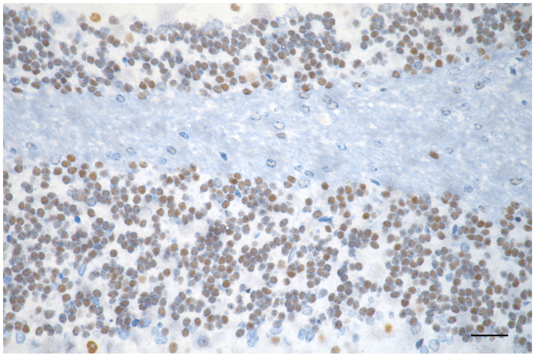 [KD Validated] Anti-MEF2A Rabbit mAb [92J73H09]