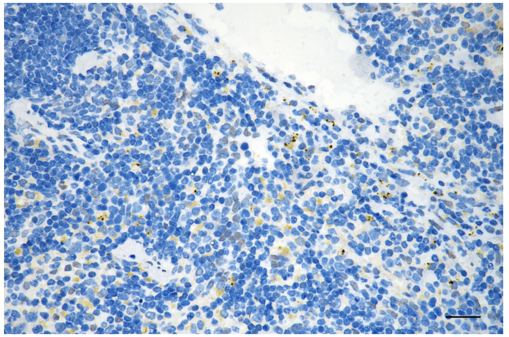 [KD Validated] Anti-MEF2A Rabbit mAb [92J73H09]