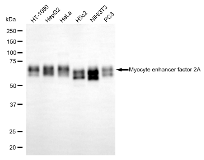 [KD Validated] Anti-MEF2A Rabbit mAb [92J73H09]