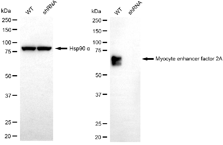 [KD Validated] Anti-MEF2A Rabbit mAb [92J73H09]