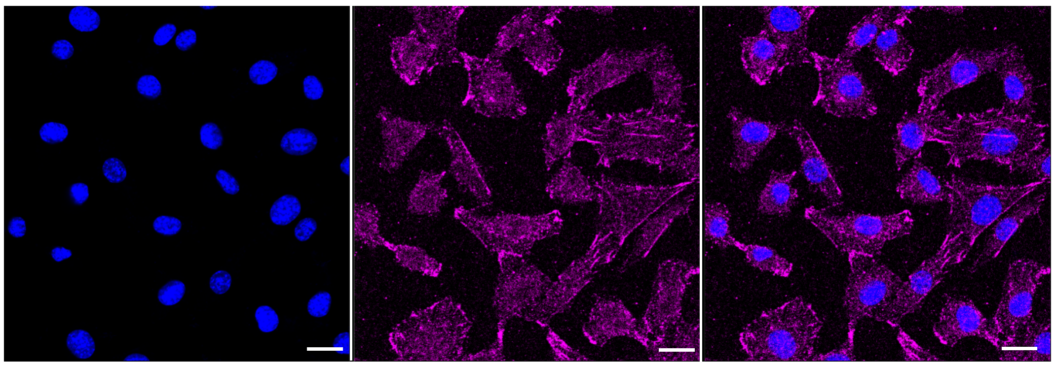 [KD Validated] Anti-ELP4 Rabbit mAb [56S03S37]