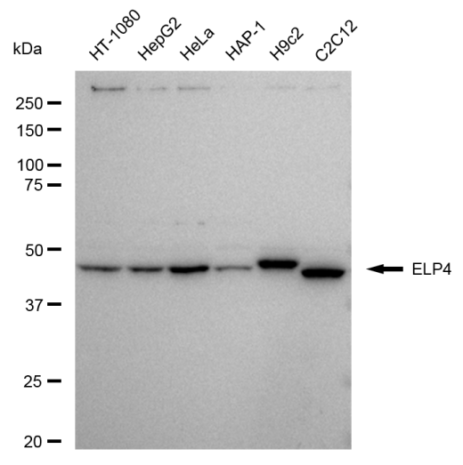 [KD Validated] Anti-ELP4 Rabbit mAb [56S03S37]