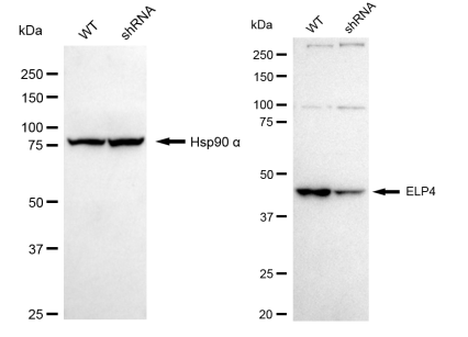 [KD Validated] Anti-ELP4 Rabbit mAb [56S03S37]