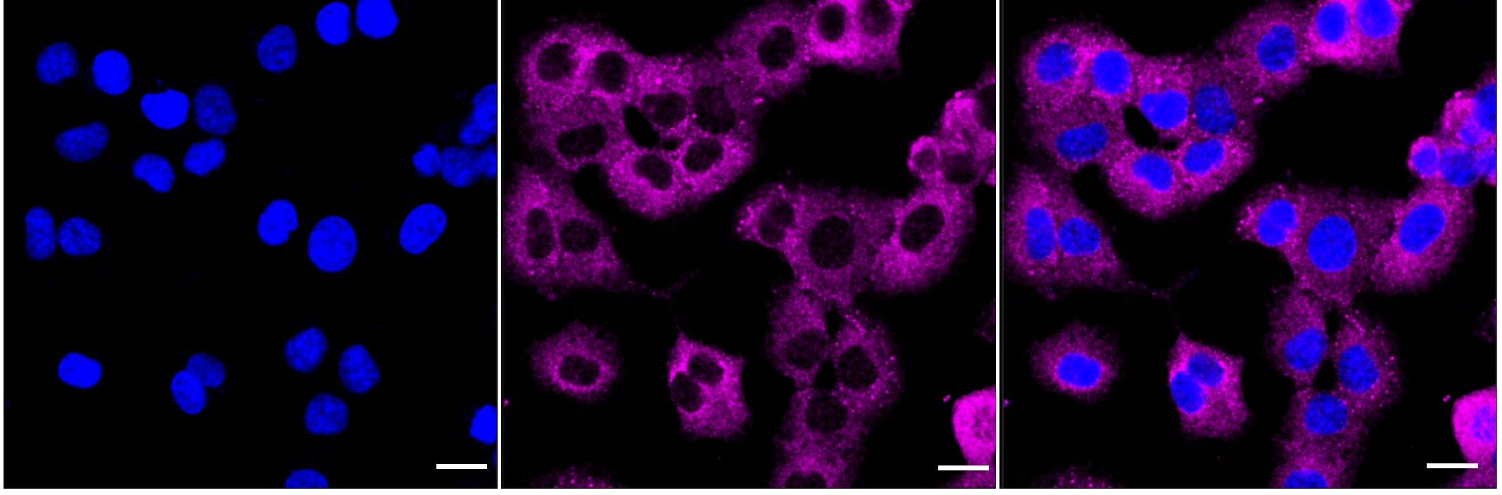 [KD Validated] Anti-DCP1A Rabbit mAb [46C53S29]