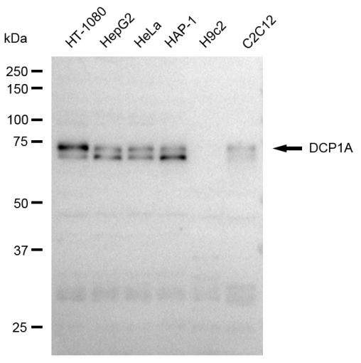 [KD Validated] Anti-DCP1A Rabbit mAb [46C53S29]