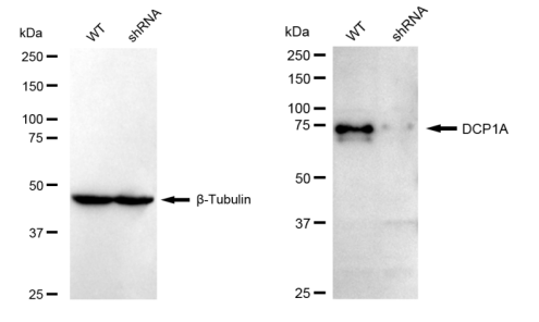 [KD Validated] Anti-DCP1A Rabbit mAb [46C53S29]