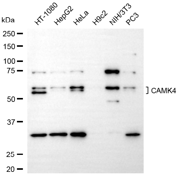 [KD Validated] Anti-CAMK4 Rabbit mAb [42M18T06]