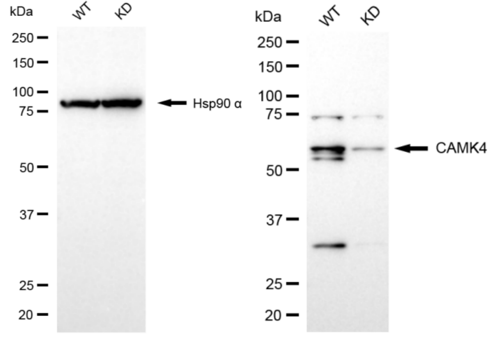 [KD Validated] Anti-CAMK4 Rabbit mAb [42M18T06]