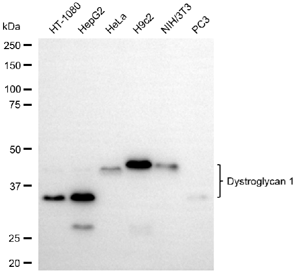 [KD Validated] Anti-DAG1 Rabbit mAb [41H43F28]