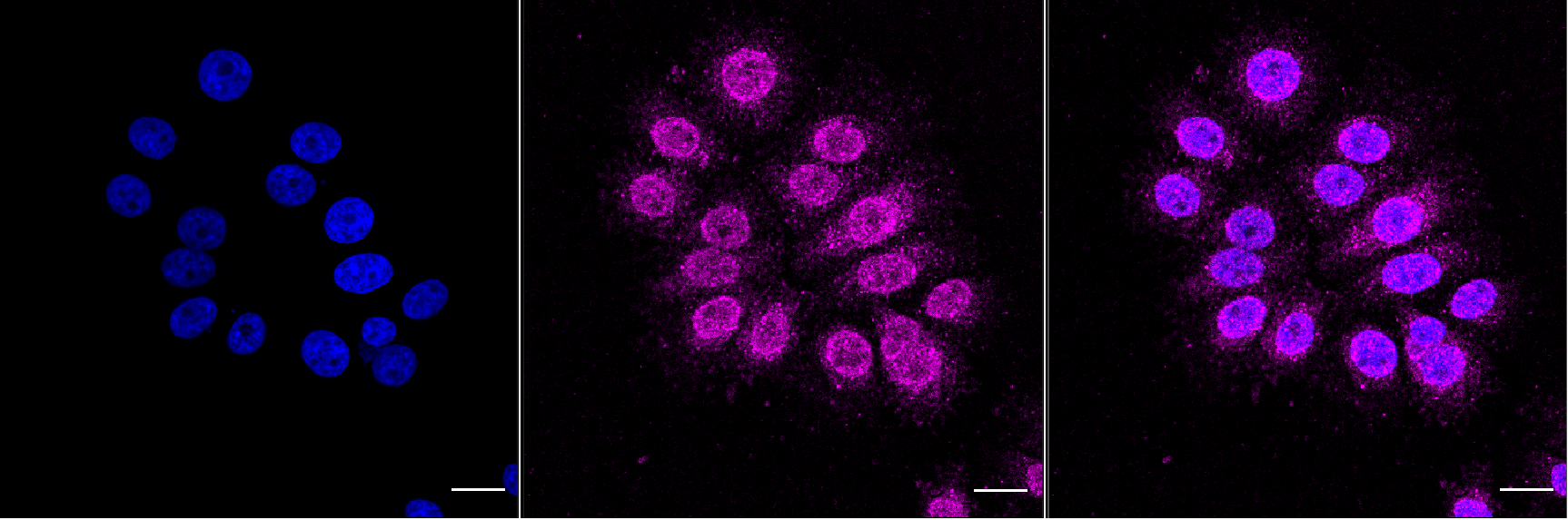 [KD Validated] Anti-NFKBIA Rabbit mAb [91G70D43]