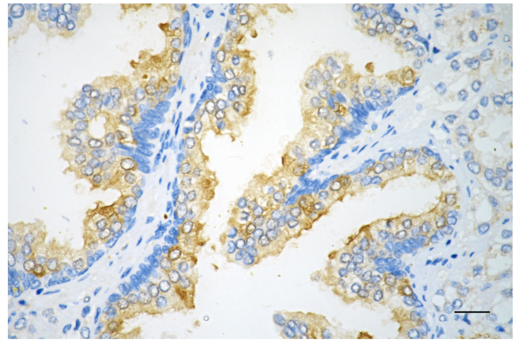 [KD Validated] Anti-NFKBIA Rabbit mAb [91G70D43]