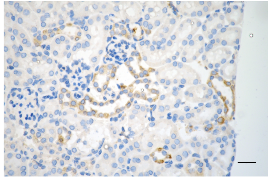 [KD Validated] Anti-NFKBIA Rabbit mAb [91G70D43]