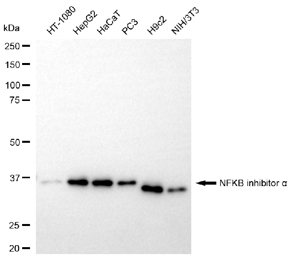 [KD Validated] Anti-NFKBIA Rabbit mAb [91G70D43]