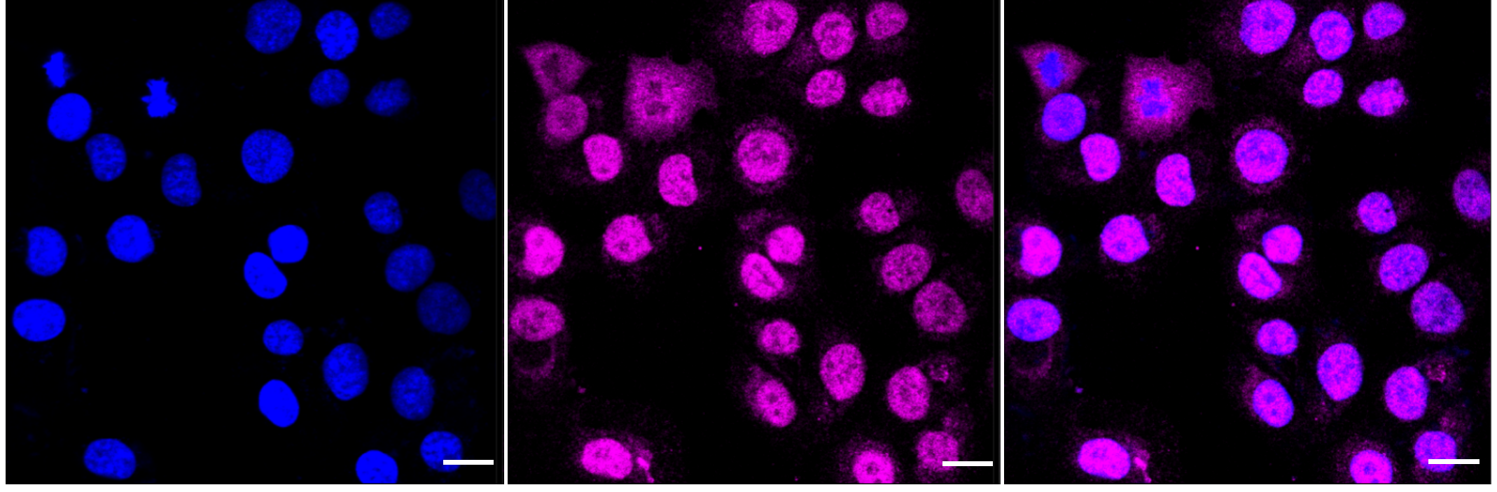 [KD Validated] Anti-PFKFB3 Rabbit mAb [32O71F11]