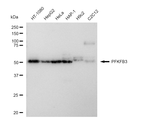 [KD Validated] Anti-PFKFB3 Rabbit mAb [32O71F11]