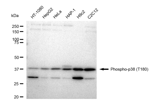 [KD Validated] Anti-Phospho-p38 (Thr180) Rabbit mAb [65E52J81]