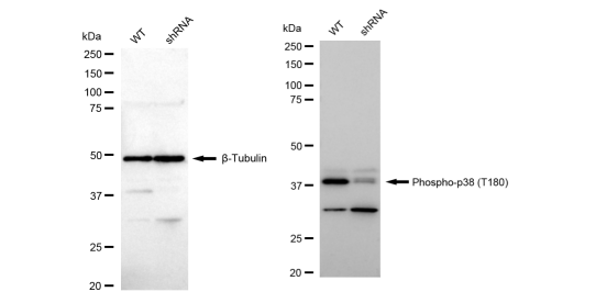 [KD Validated] Anti-Phospho-p38 (Thr180) Rabbit mAb [65E52J81]