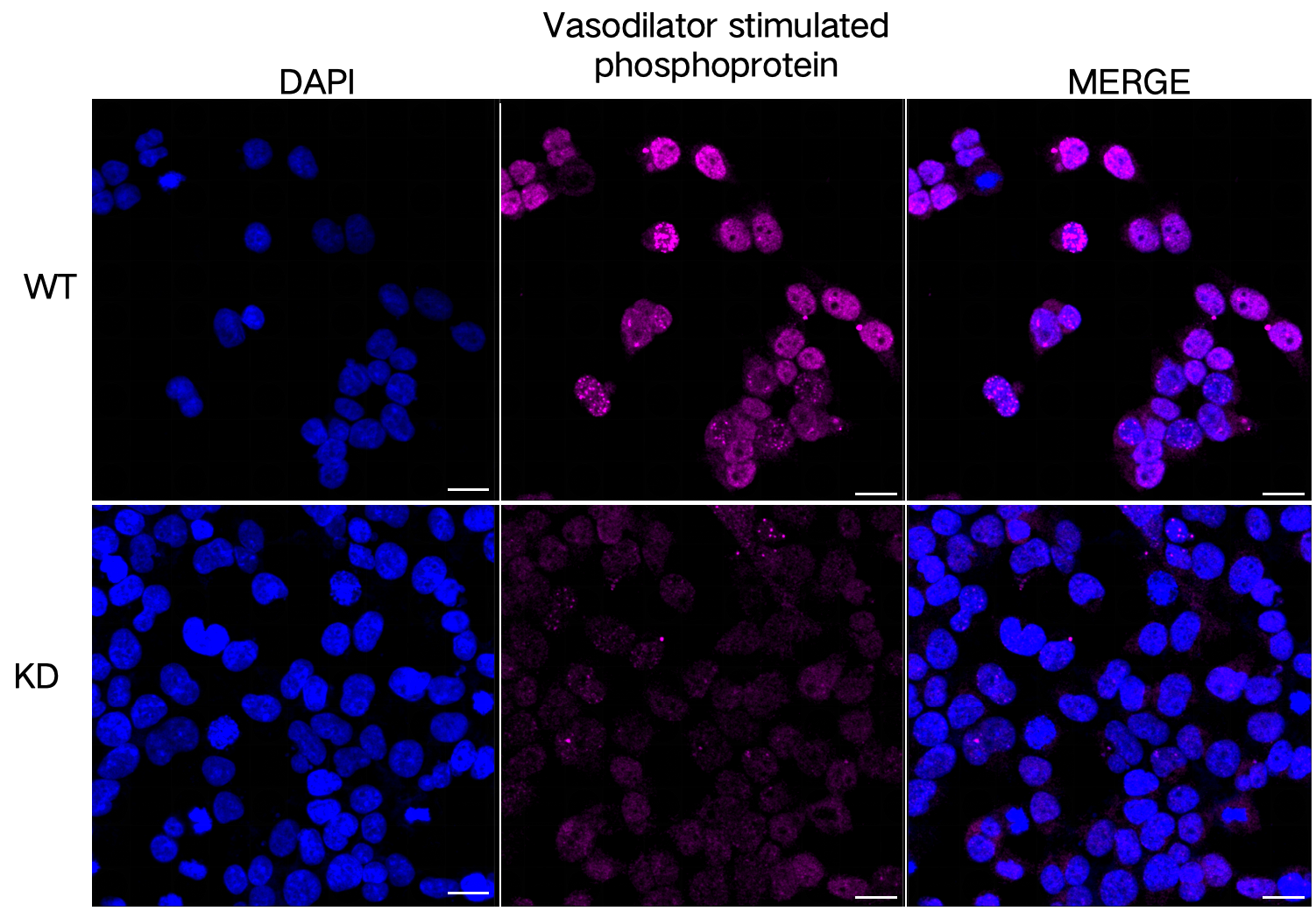 [KD Validated] Anti-VASP Rabbit mAb [24C85B30]