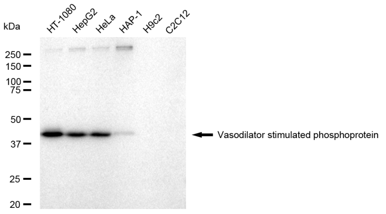 [KD Validated] Anti-VASP Rabbit mAb [24C85B30]