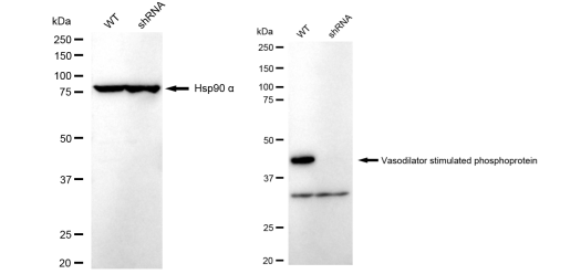 [KD Validated] Anti-VASP Rabbit mAb [24C85B30]