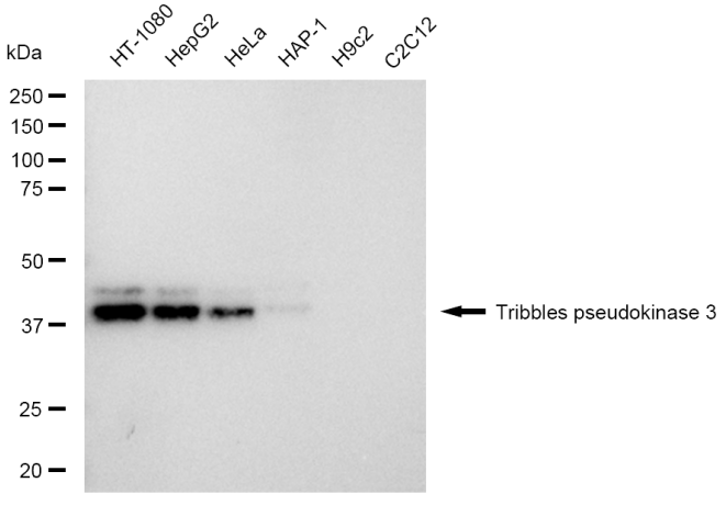 [KD Validated] Anti-TRIB3 Rabbit mAb [70O92G34]