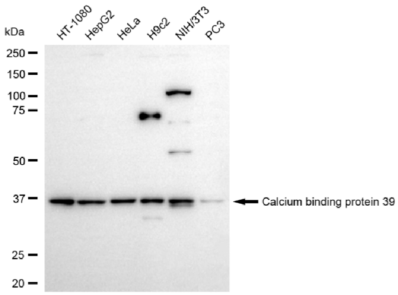 [KD Validated] Anti-CAB39 Rabbit mAb [95L48G21]