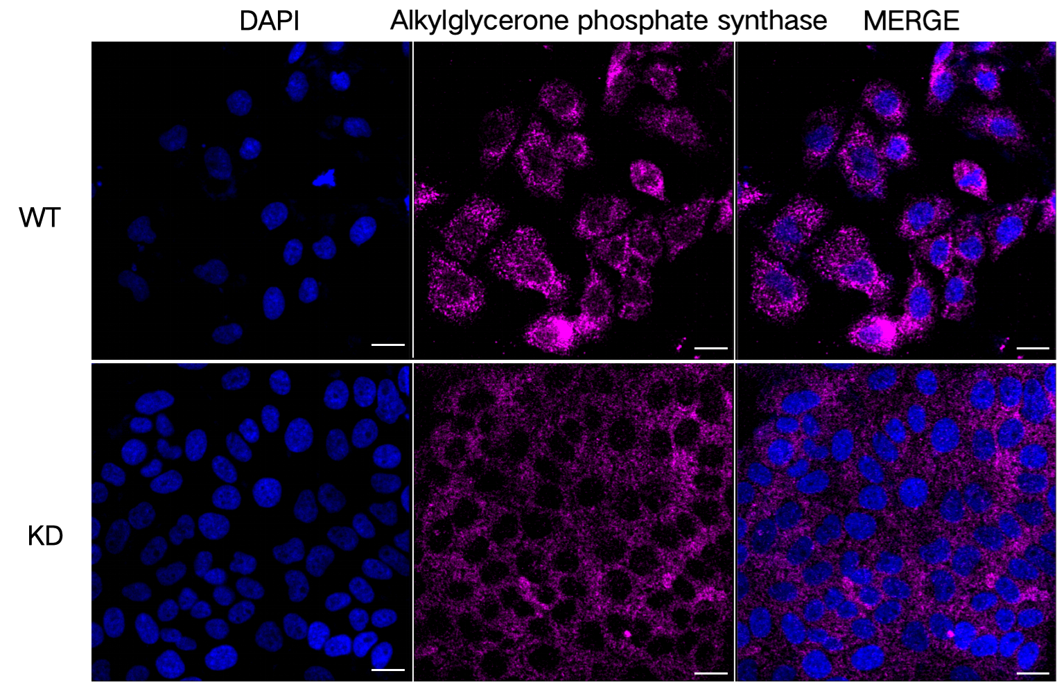 [KD Validated] Anti-AGPS Rabbit mAb [61Q68H44]
