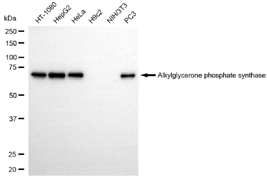 [KD Validated] Anti-AGPS Rabbit mAb [61Q68H44]