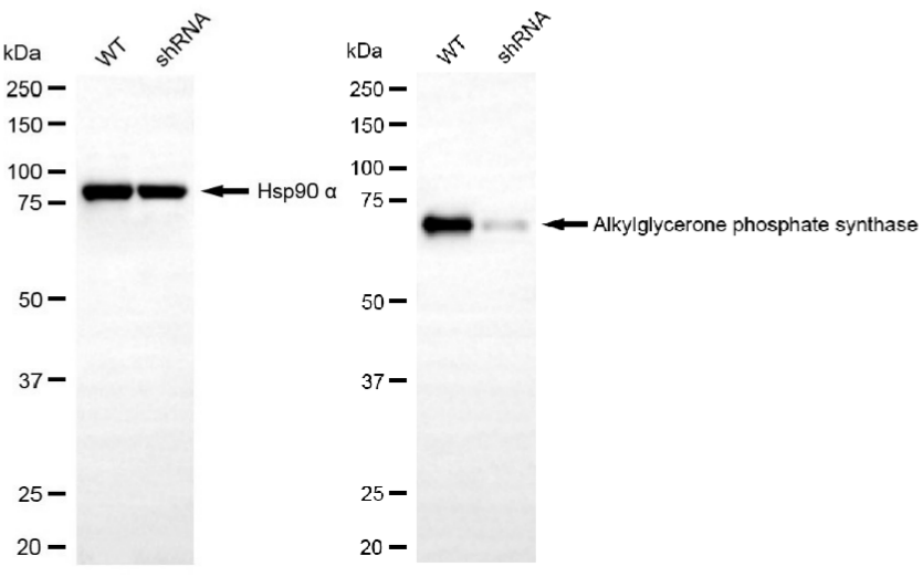 [KD Validated] Anti-AGPS Rabbit mAb [61Q68H44]