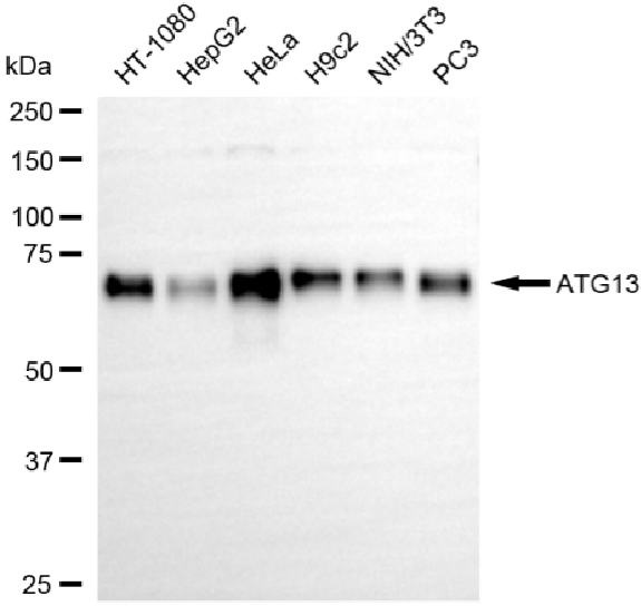 [KD Validated] Anti-ATG13 Rabbit mAb [80E09L74]