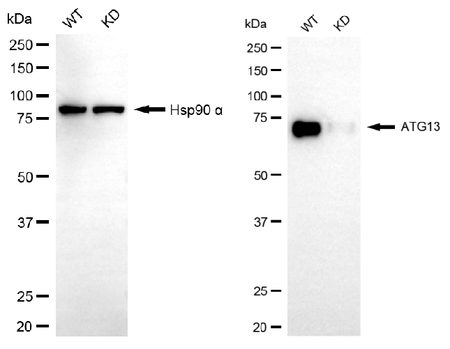 [KD Validated] Anti-ATG13 Rabbit mAb [80E09L74]