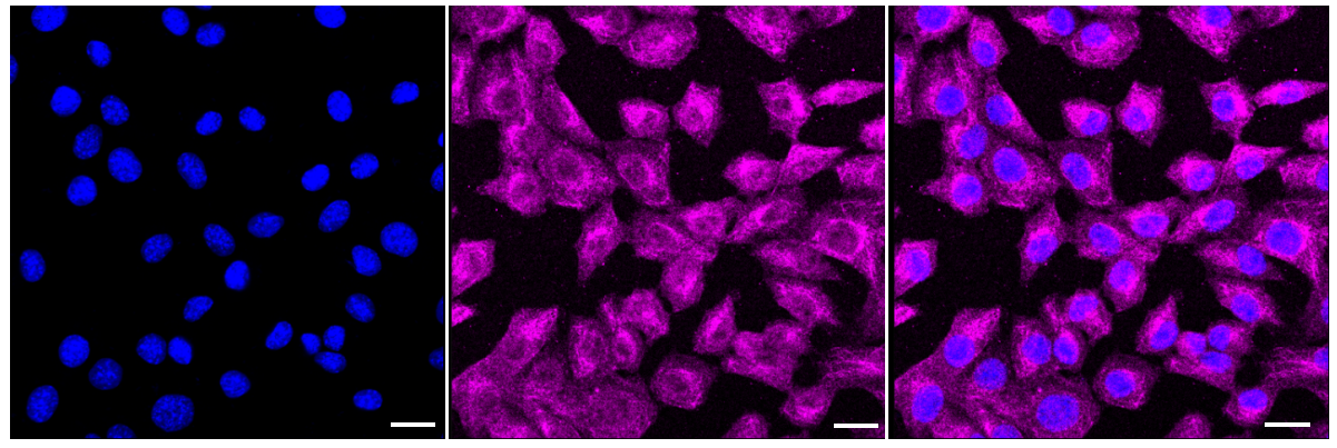 [KD Validated] Anti-MAPK1/3 Rabbit mAb [43S59O21]