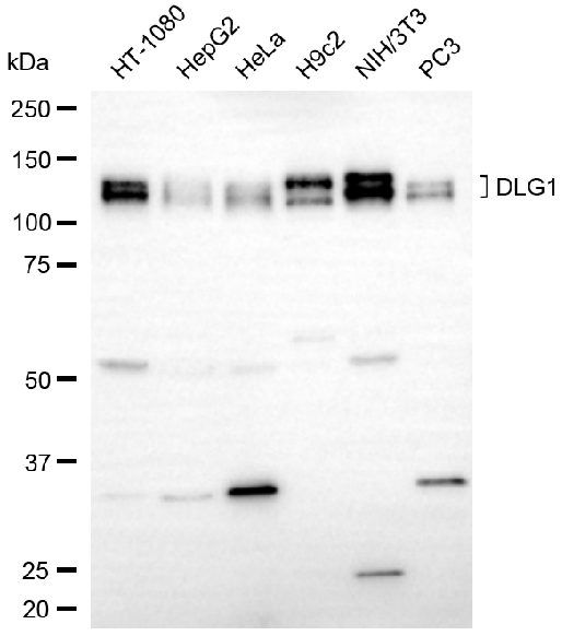 [KD Validated] Anti-DLG1 Rabbit mAb [62M03F75]
