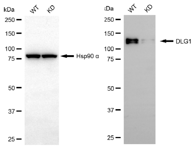 [KD Validated] Anti-DLG1 Rabbit mAb [62M03F75]