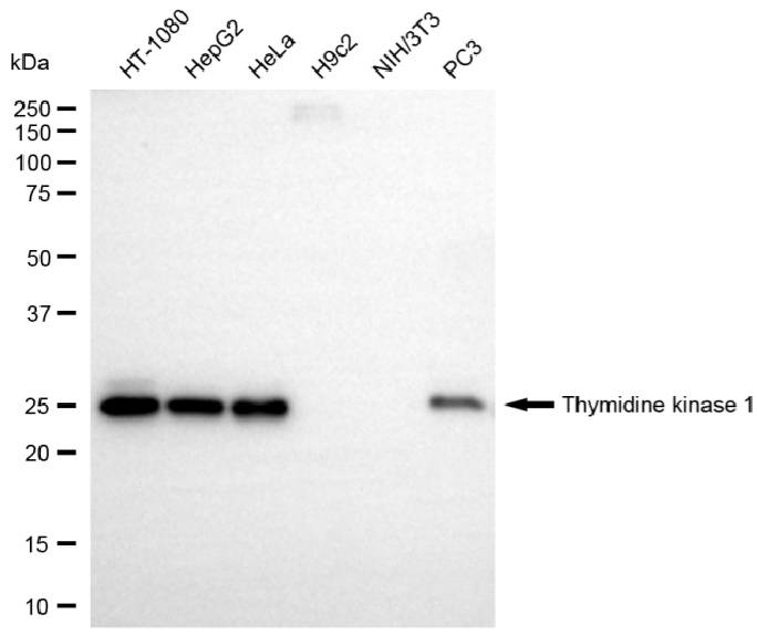 [KD Validated] Anti-TK1 Rabbit mAb [73L80R38]