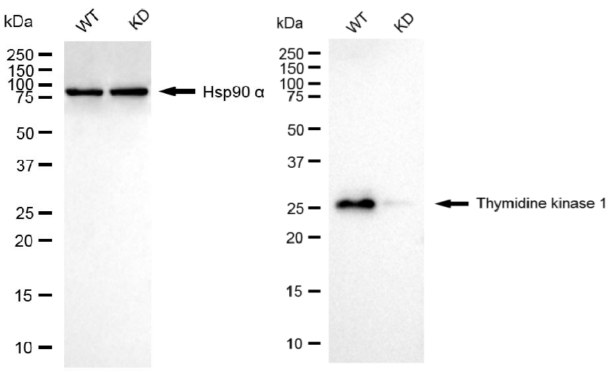 [KD Validated] Anti-TK1 Rabbit mAb [73L80R38]