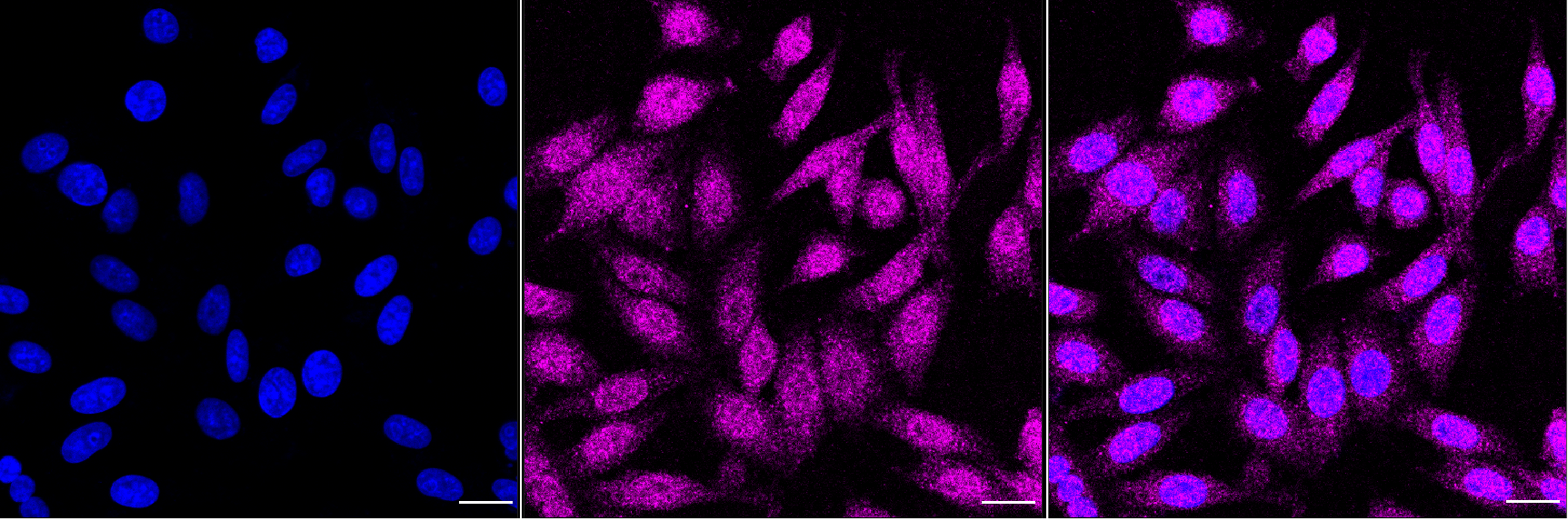 [KD Validated] Anti-PLCG1 Rabbit mAb [72E48F92]