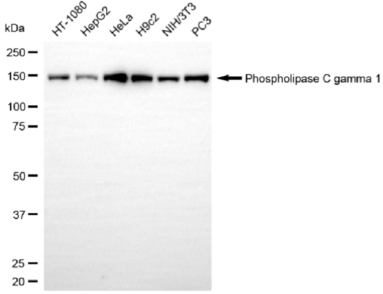 [KD Validated] Anti-PLCG1 Rabbit mAb [72E48F92]