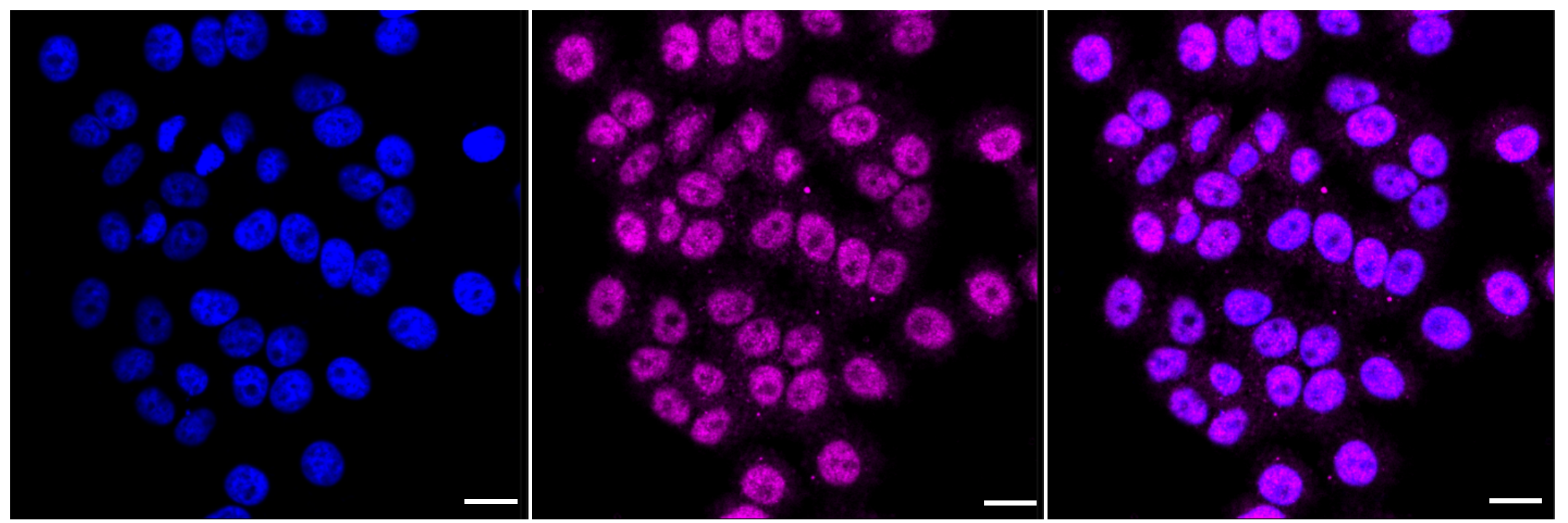 [KD Validated] Anti-ATG5 Rabbit mAb [90F85B61]