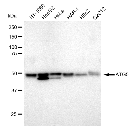 [KD Validated] Anti-ATG5 Rabbit mAb [90F85B61]