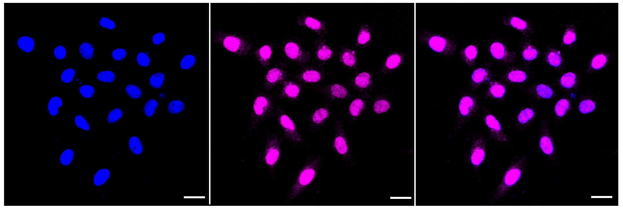 [KD Validated] Anti-TRIM24 Rabbit mAb [41S83E06]